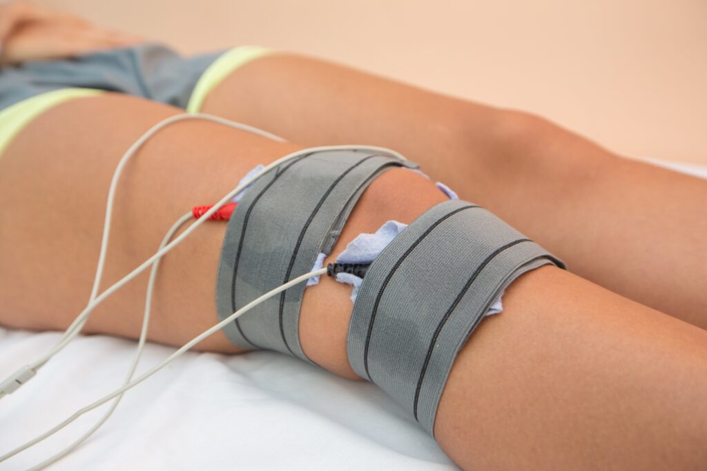 Leg with multiple ECG electrodes taped to the skin and connected by white cables lying on a bed for a medical procedure